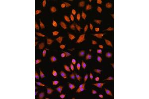 Immunofluorescence analysis of L929 cells using PI4KA Rabbit pAb (ABIN7269286) at dilution of 1:100. (PI4KA antibody)