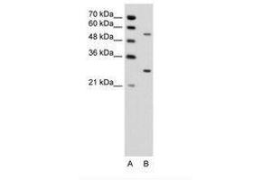Image no. 1 for anti-3-phosphoinositide Dependent Protein Kinase-1 (PDPK1) (AA 201-250) antibody (ABIN6736342)