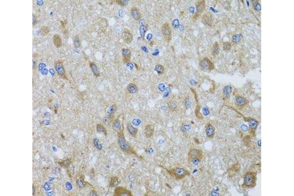 DYNC1I1 antibody