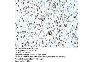 Rabbit Anti-HNRPA1 Antibody  Paraffin Embedded Tissue: Human Heart Cellular Data: Myocardial cells Antibody Concentration: 4.