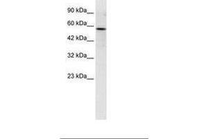 Image no. 1 for anti-RUN and FYVE Domain Containing 3 (RUFY3) (C-Term) antibody (ABIN6735951) (RUFY3 antibody  (C-Term))