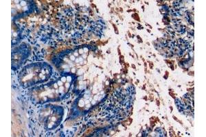Detection of C5a in Rat Colon Tissue using Monoclonal Antibody to Complement Component 5a (C5a) (C5A antibody  (AA 1-77))