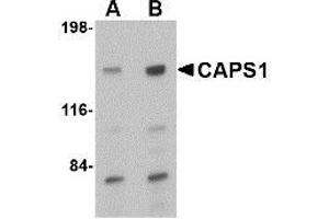 Western blot analysis of CAPS1 in rat brain tissue lysate with AP30178PU-N CAPS1 antibody at (A) 0. (CADPS antibody  (C-Term))