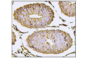 IHC analysis of Nectin 2/NECTIN2 using anti-Nectin 2/NECTIN2 antibody (ABIN7601304).