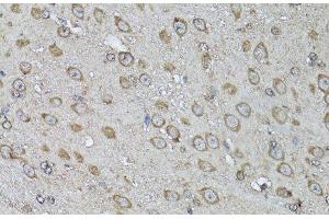 Immunohistochemistry of paraffin-embedded Mouse brain using Snail Polyclonal Antibody at dilution of 1:100 (40x lens). (SNAIL antibody)