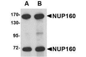 Image no. 1 for anti-Nucleoporin 160kDa (NUP160) (C-Term) antibody (ABIN1103361) (NUP160 antibody  (C-Term))
