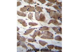ACTN3 Antibody (Center) immunohistochemistry analysis in formalin fixed and paraffin embedded human skeletal muscle followed by peroxidase conjugation of the secondary antibody and DAB staining. (ACTN3 antibody  (Middle Region))