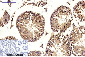 Immunohistochemical analysis of paraffin-embedded mouse testis tissue. (MICU1 antibody)