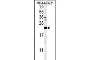 Western blot analysis of IL1F6 Antibody (Center) (ABIN651427 and ABIN2840233) in MDA-M cell line lysates (35 μg/lane). (IL36A/IL1F6 antibody  (AA 35-61))