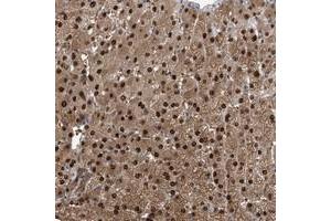 Immunohistochemical staining of human liver with C11orf73 polyclonal antibody  shows strong nuclear and cytoplasmic positivity in hepatocytes at 1:500-1:1000 dilution.