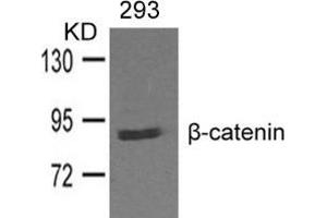 Western blot analysis of extracts from 293 cells and using β-catenin. (CTNNB1 antibody  (AA 327-331))