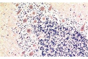 Immunohistochemistry of paraffin-embedded Human brain tissue using MAP1LC3B Monoclonal Antibody at dilution of 1:200. (LC3B antibody)