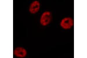 ABIN6272454 staining HeLa by IF/ICC. (Cytidine Monophosphate (UMP-CMP) Kinase 1, Cytosolic (CMPK1) (N-Term) antibody)