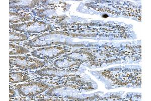 ABIN6260850 and ABIN6273034 at 1/100 staining Rat colon tissue by IHC-P. (CKAP4 antibody  (C-Term))