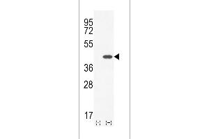 Western blot analysis of CLEC11A using rabbit polyclonal CLEC11A Antibody using 293 cell lysates (2 ug/lane) either nontransfected (Lane 1) or transiently transfected (Lane 2) with the CLEC11A gene. (CLEC11A antibody  (AA 145-174))