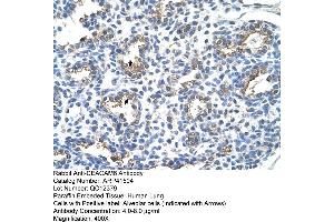 Rabbit Anti-CEACAM6 Antibody  Paraffin Embedded Tissue: Human Lung Cellular Data: Alveolar cells Antibody Concentration: 4. (CEACAM6 antibody  (Middle Region))
