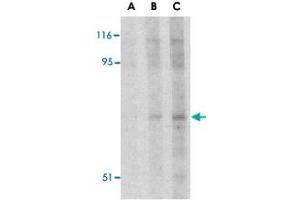 Western blot analysis of RPS6KA1 in Jurkat cell lysate with RPS6KA1 polyclonal antibody  at (A) 2.