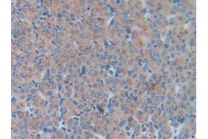 Detection of LCN5 in Mouse Ovary Tissue using Polyclonal Antibody to Lipocalin 5 (LCN5) (LCN5 antibody  (AA 28-187))