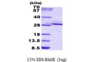 FGF17 Protein (AA 23-216) (His tag)
