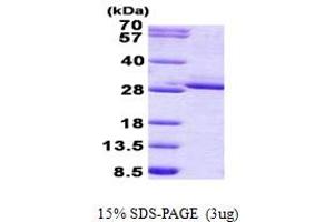 SDS-PAGE (SDS) image for Fibroblast Growth Factor 17 (FGF17) (AA 23-216) protein (His tag) (ABIN5852968)