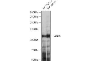 Western blot analysis of extracts of various cell lines, using SENP6 antibody (ABIN7270635) at 1:1000 dilution. (SENP6 antibody  (AA 811-1112))