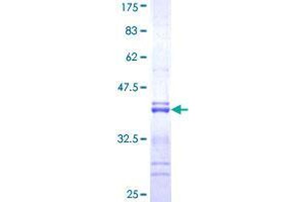 RNF123 Protein (AA 1216-1314) (GST tag)