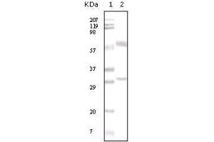 Western Blot showing ER-alpha antibody used against human breast carcinoma tissue lysate. (Estrogen Receptor alpha antibody  (AA 410-592))