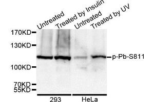 Western Blotting (WB) image for anti-Retinoblastoma 1 (RB1) (pSer811) antibody (ABIN3023610) (Retinoblastoma 1 antibody  (pSer811))