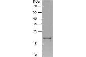 Western Blotting (WB) image for Proteasome (Prosome, Macropain) Subunit, beta Type 10 (PSMB10) (AA 40-237) protein (His tag) (ABIN7286090) (PSMB10 Protein (AA 40-237) (His tag))