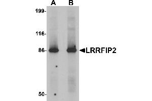 Western blot analysis of LRRFIP2 in rat colon tissue lysate with LRRFIP2 antibody at (A) 0. (LRRFIP2 antibody  (C-Term))