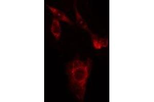 ABIN6274960 staining HuvEc cells by IF/ICC. (CA3 antibody  (N-Term))