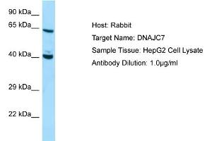 Western Blotting (WB) image for anti-DnaJ (Hsp40) Homolog, Subfamily C, Member 7 (DNAJC7) (C-Term) antibody (ABIN970539) (DNAJC7 antibody  (C-Term))