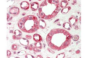 Human Kidney: Formalin-Fixed, Paraffin-Embedded (FFPE). (TRIB1 antibody  (C-Term))