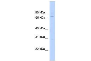 EFHC1 antibody used at 0. (EFHC1 antibody  (N-Term))