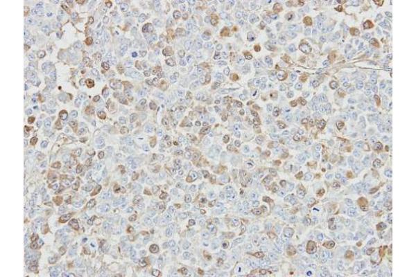 USP5 antibody