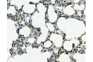IHC analysis of REC8 using anti-REC8 antibody (ABIN7599473). (REC8 antibody  (AA 1-547))