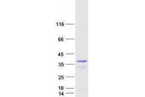 DnaJ (Hsp40) Homolog, Subfamily C, Member 9 (DNAJC9) protein (Myc-DYKDDDDK Tag)