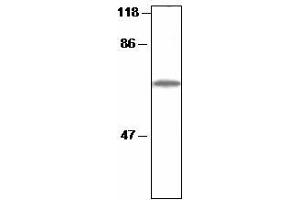 Western blot analysis of Arabidopsis thylakoid proteins with anti-CF1 beta (CF1 beta (AtpB) antibody)
