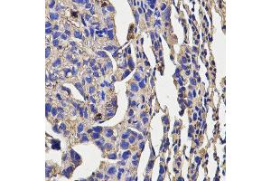 Immunohistochemistry (IHC) image for anti-Killer Cell Lectin-Like Receptor Subfamily D, Member 1 (KLRD1) (AA 32-179) antibody (ABIN3022763) (CD94 antibody  (AA 32-179))