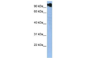 WB Suggested Anti-ZFY Antibody Titration:  0. (ZFY antibody  (N-Term))