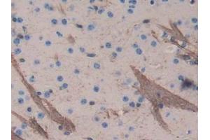 DAB staining on IHC-P; Samples: Mouse Cerebrum Tissue (Aggrecan antibody  (AA 587-684))
