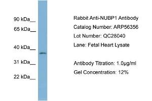 WB Suggested Anti-NUBP1  Antibody Titration: 0. (NUBP1 antibody  (Middle Region))