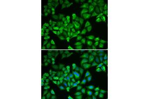 Immunofluorescence analysis of A549 cells using FTL antibody (ABIN5970889).