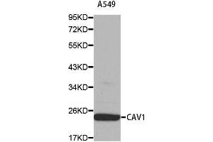 Western blot analysis of extracts of A549 cell using CAV1 antibody. (Caveolin-1 antibody  (AA 1-100))