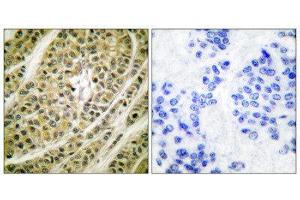 Immunohistochemistry (IHC) image for anti-Histone Deacetylase 5 (HDAC5) (C-Term) antibody (ABIN1848600) (HDAC5 antibody  (C-Term))