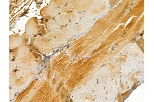 ABIN6261614 and ABIN6273044 at 1/100 staining Mouse skin tissue by IHC-P.
