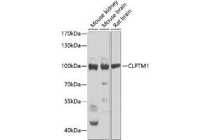 Western blot analysis of extracts of various cell lines, using CLPTM1 Antibody (ABIN6128987, ABIN6138748, ABIN6138749 and ABIN6223577) at 1:1000 dilution. (CLPTM1 antibody  (AA 1-280))