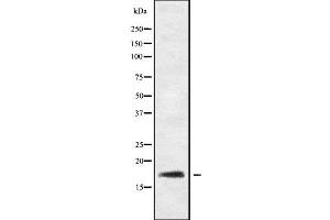 RGS21 antibody  (N-Term)