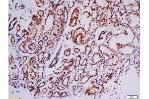 Formalin-fixed and paraffin embedded human kidney labeled with Rabbit Anti-RSK2(Tyr529) Polyclonal Antibody, Unconjugated (ABIN745283) at 1:200 followed by conjugation to the secondary antibody and DAB staining (RPS6KA3 antibody  (pTyr529))