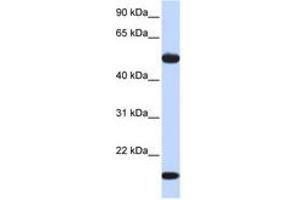 ADSSL1 抗体  (AA 144-193)